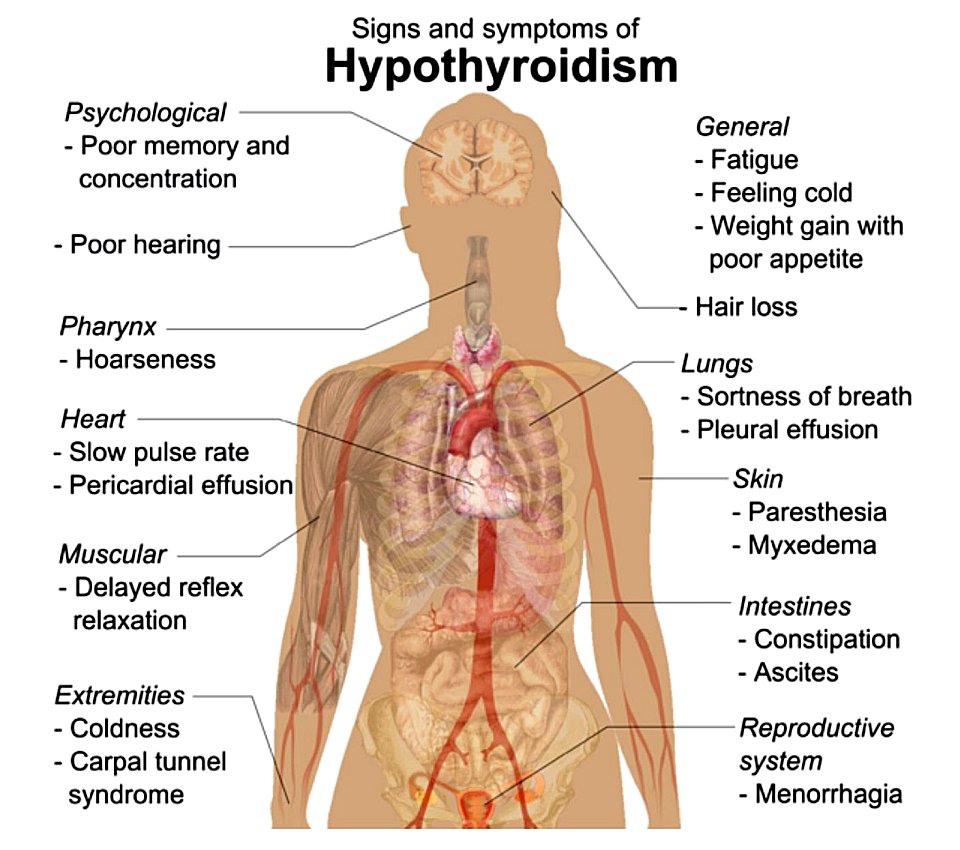 hypothyroidism-alternative-resources-directory