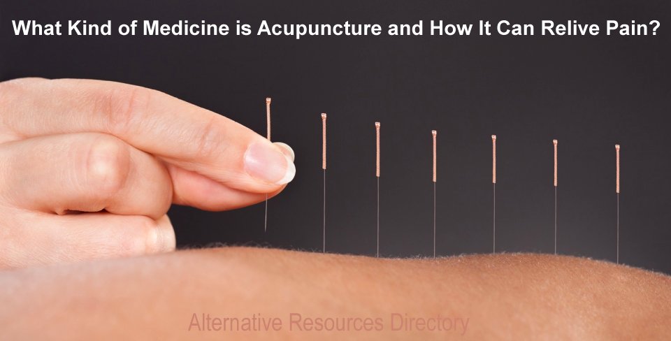 What kind of medicine is acupuncture and how it Can relive pain