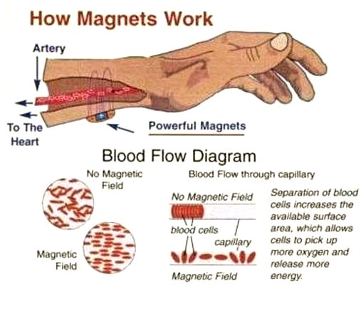 magnetic-therapy-proven-to-reduce-pain